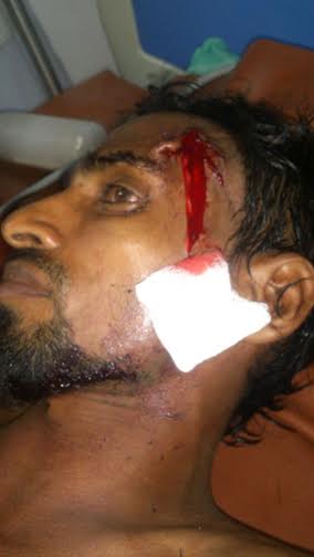 Cricket match dispute : 2 brothers attacked by 2 other brothers! 2